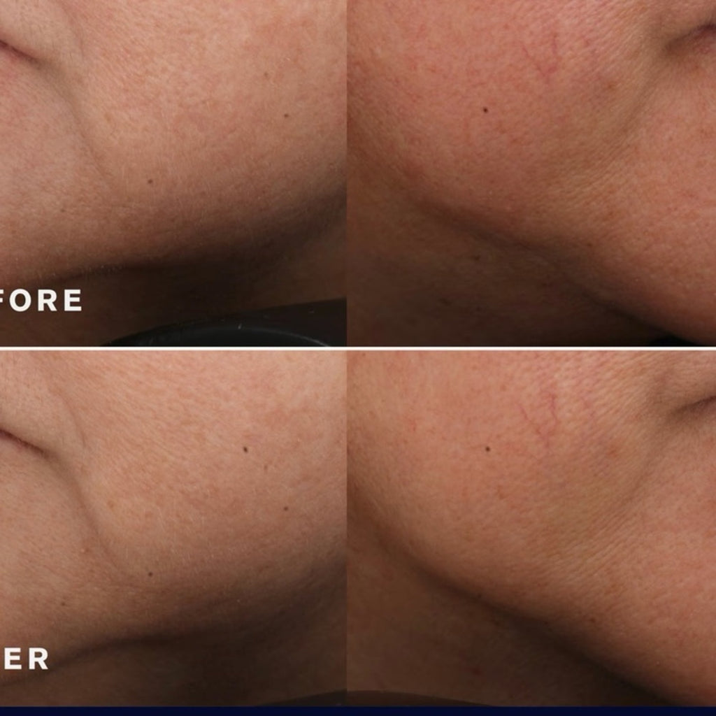 ESTEE LAUDER REVITALIZING SUPREME+ YOUTH POWER CREME 2.5 OZ