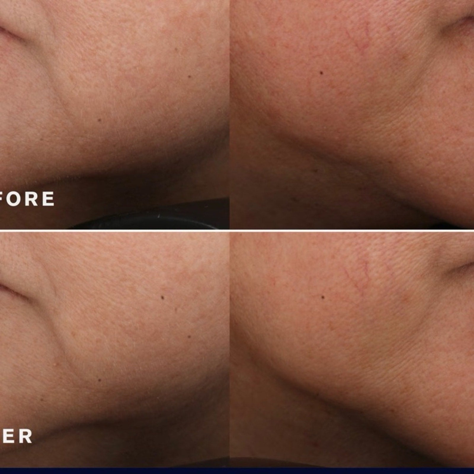 ESTEE LAUDER REVITALIZING SUPREME+ YOUTH POWER CREME 2.5 OZ